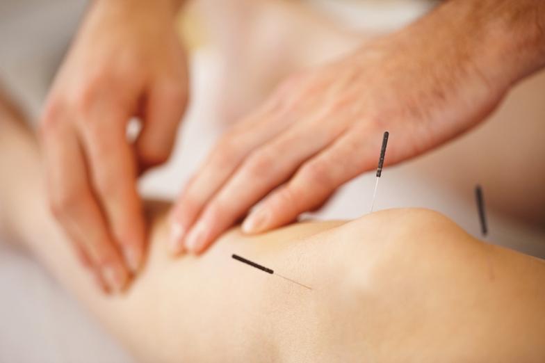 acupuncture_knee